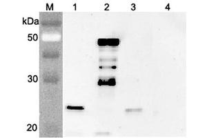 Western blot analysis using anti-FGF-21 (mouse), pAb  at 1:4'000 dilution. (FGF21 antibody)