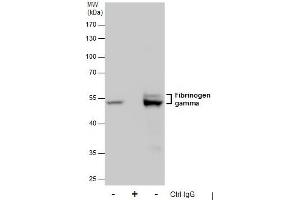 IP Image Immunoprecipitation of Fibrinogen gamma protein from HepG2 whole cell extracts using 5 μg of Fibrinogen gamma antibody, Western blot analysis was performed using Fibrinogen gamma antibody, EasyBlot anti-Rabbit IgG  was used as a secondary reagent. (FGG antibody)