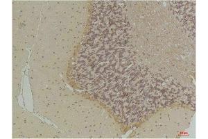 Immunohistochemical analysis of paraffin-embedded Rat BrainTissue using GABA Transporter 1 Rabbit pAb diluted at 1:200. (SLC6A1 antibody)
