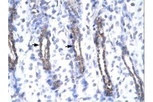 Image no. 2 for anti-Matrix Metallopeptidase 19 (MMP19) (AA 56-105) antibody (ABIN6735807) (MMP19 antibody  (AA 56-105))