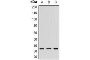 Western blot analysis of CD152 expression in K562 (A), mouse spleen (B), rat thymus (C) whole cell lysates. (CTLA4 antibody)