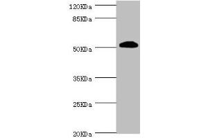 Western blot All lanes: ZC3HC1 antibody at 1. (ZC3HC1 antibody  (AA 1-260))