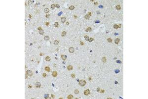 Immunohistochemistry of paraffin-embedded mouse brain using RNASEL antibody. (RNASEL antibody)