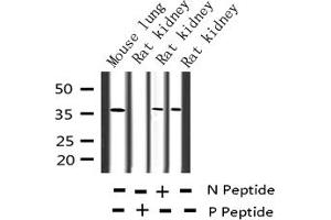 Western blot analysis of Phospho-c-Jun (Thr91) expression in various lysates (C-JUN antibody  (pThr91))