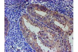 Image no. 1 for anti-Paraneoplastic Antigen MA3 (PNMA3) (AA 1-250) antibody (ABIN1490635) (PNMA3 antibody  (AA 1-250))