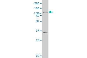 MARCH6 polyclonal antibody (A01), Lot # 051107JC01 Western Blot analysis of MARCH6 expression in MES-SA/Dx5 . (MARCH6 antibody  (AA 2-91))