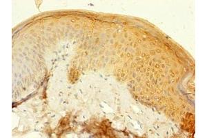 Immunohistochemistry of paraffin-embedded human skin tissue using ABIN7157416 at dilution of 1:100