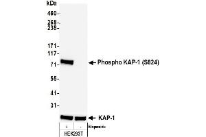 Western Blotting (WB) image for anti-Tripartite Motif Containing 28 (TRIM28) (pSer824) antibody (ABIN7454038)