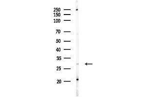 Western blot analysis of lysates from Hela cells(starvation,24h treatment), using RPS4Y1 Antibody at 1/1000 dilution.