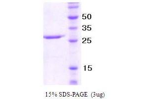 SDS-PAGE (SDS) image for Neutrophil Migration (NM) (AA 22-255) protein (ABIN666806) (Neutrophil Migration (NM) (AA 22-255) Protein)