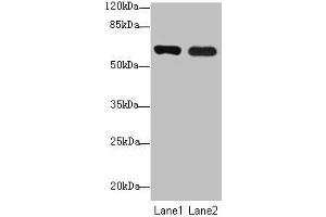 Western blot All lanes: SPTLC3 antibody at 0. (SPTLC3 antibody  (AA 1-58))