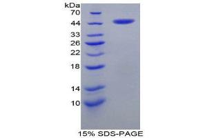 SDS-PAGE (SDS) image for Corticotropin Releasing Hormone (CRH) (AA 40-195) protein (His tag,GST tag) (ABIN2122705)