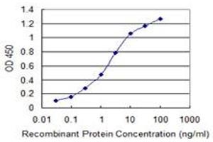 Detection limit for recombinant GST tagged SIX4 is 0. (SIX4 antibody  (AA 672-780))