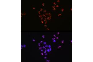 Immunofluorescence analysis of HeLa cells using Phospho-p70 S6 Kinase 1-T421/S424 antibody (ABIN6135340, ABIN6136296, ABIN6136297 and ABIN7101878). (RPS6KB1 antibody  (pSer424, pThr421))