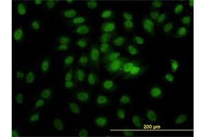 Immunofluorescence of monoclonal antibody to CSE1L on HeLa cell. (Exportin 2 antibody  (AA 872-971))