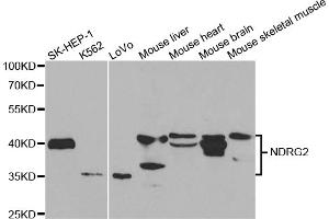 Western blot analysis of extracts of various cell lines, using NDRG2 antibody (ABIN5973062) at 1/1000 dilution. (NDRG2 antibody)