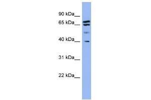 WB Suggested Anti-SH3GL2 Antibody Titration: 0. (SH3G2 antibody  (Middle Region))