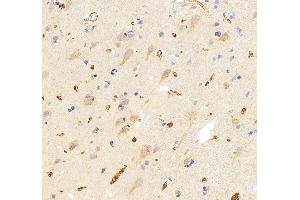 IHC analysis of SLC25A13 using anti-SLC25A13 antibody (ABIN7599512). (slc25a13 antibody  (AA 1-643))