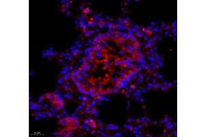Immunofluorescence of paraffin embedded rat lung using ARHGAP18 (ABIN7075417) at dilution of 1: 700 (400x lens)