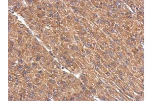 IHC-P Image Immunohistochemical analysis of paraffin-embedded U87 xenograft, using PPP2R1A, antibody at 1:500 dilution. (PPP2R1A antibody  (Center))