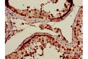 Immunohistochemistry of paraffin-embedded human testis tissue using ABIN7143044 at dilution of 1:100 (ABLIM3 antibody  (AA 266-544))