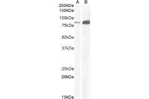Immunohistochemistry (IHC) image for anti-Cholecystokinin B Receptor (CCKBR) (Internal Region) antibody (ABIN185407)