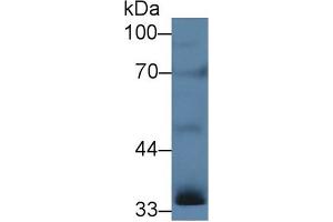 Western blot analysis of Rat Testis lysate, using Human INHA Antibody (5 µg/ml) and HRP-conjugated Goat Anti-Rabbit antibody ( (Inhibin alpha antibody  (AA 25-363))