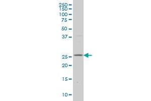 DCUN1D1 monoclonal antibody (M01), clone 3D7 Western Blot analysis of DCUN1D1 expression in HepG2 . (DCUN1D1 antibody  (AA 1-89))