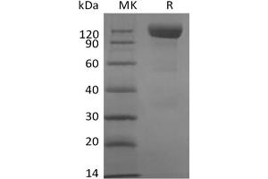 Western Blotting (WB) image for Sialic Acid Binding Ig-Like Lectin 10 (SIGLEC10) (Active) protein (mFc Tag) (ABIN7319820) (SIGLEC10 Protein (mFc Tag))