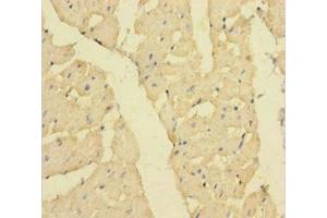 Immunohistochemistry of paraffin-embedded human heart tissue using ABIN7160357 at dilution of 1:100 (MBNL1 antibody  (AA 1-382))