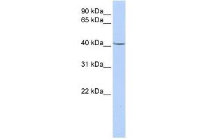 GPD1 antibody used at 1 ug/ml to detect target protein.