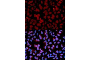 Immunofluorescence analysis of U2OS cell using TNFAIP3 antibody. (TNFAIP3 antibody  (AA 1-190))