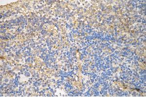 Immunohistochemistry was performed on paraffin-embedded mouse spleen using NF-kB p65 antibody (ABIN7799645), 1:200). (Recombinant NF-kB p65 antibody)