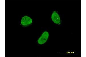Immunofluorescence of monoclonal antibody to ZNF7 on HeLa cell. (ZNF7 antibody  (AA 67-165))