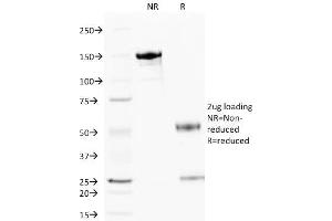 SDS-PAGE Analysis Purified Cytochrome C Mouse Monoclonal Antibody (6H2. (Cytochrome C antibody)
