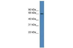 WB Suggested Anti-TBC1D19 Antibody Titration: 0. (TBC1D19 antibody  (Middle Region))