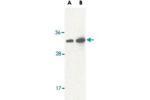 Western blot analysis of STRADB in human brain lysate with STRADB polyclonal antibody  at (A) 1 and (B) 2 ug/mL .