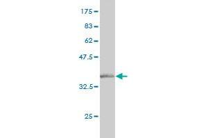 Western Blot detection against Immunogen (36. (NELL1 antibody  (AA 304-403))