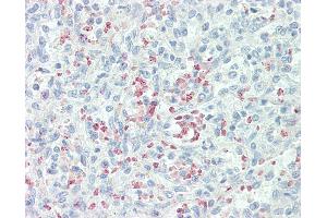 Anti-Mannose Receptor / CD206 antibody IHC staining of human spleen. (Mannose Receptor antibody  (AA 359-388))