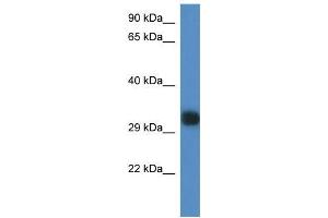 Mouse Spleen; WB Suggested Anti-Gm527 Antibody. (GM527 antibody  (C-Term))