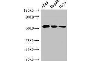 Western Blot Positive WB detected in: A549 whole cell lysate, HepG2 whole cell lysate, Hela whole cell lysate All lanes: ONECUT2 antibody at 2. (ONECUT2 antibody  (AA 214-331))