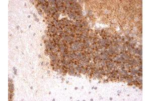Kv4. (KCND3 antibody  (C-Term))
