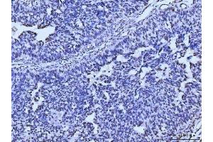 IHC analysis of MRE11 using anti-MRE11 antibody (ABIN7600025). (Mre11 antibody  (AA 14-481))