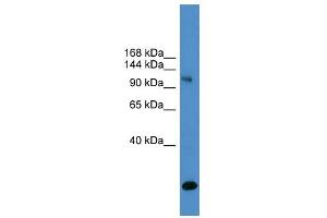 WB Suggested Anti-USP8 Antibody Titration: 0. (USP8 antibody  (C-Term))