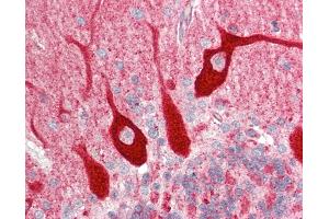 Human Brain, Cerebellum: Formalin-Fixed, Paraffin-Embedded (FFPE). (EEF1A2 antibody  (AA 360-409))