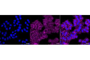 anti-Desmoglein 2 (DSG2) antibody