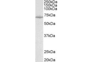 ABIN2559988 (0. (SLC6A8 antibody  (Internal Region))