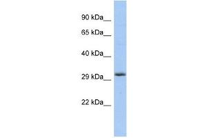 FGF13 antibody used at 1 ug/ml to detect target protein.