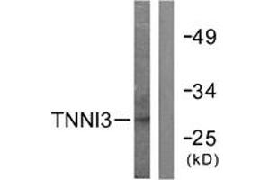 Western blot analysis of extracts from mouse heart cells, using TNNI3 (Ab-142) Antibody. (TNNI3 antibody  (AA 111-160))