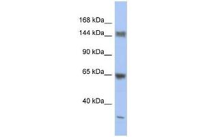 ATXN2 antibody used at 1. (Ataxin 2 antibody  (Middle Region))